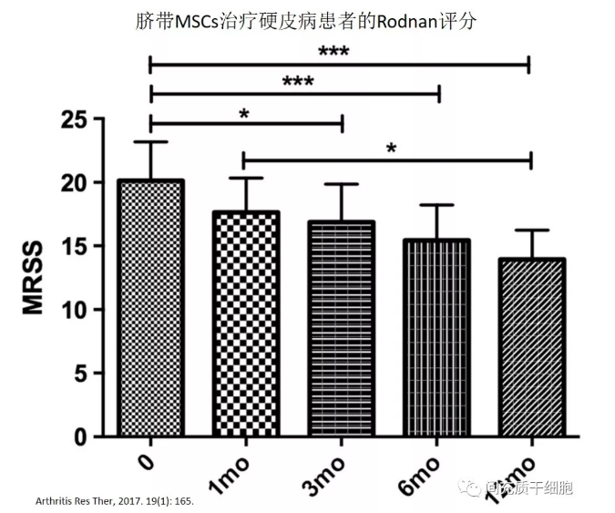 干細(xì)胞治療系統(tǒng)性硬化病，安全且有效